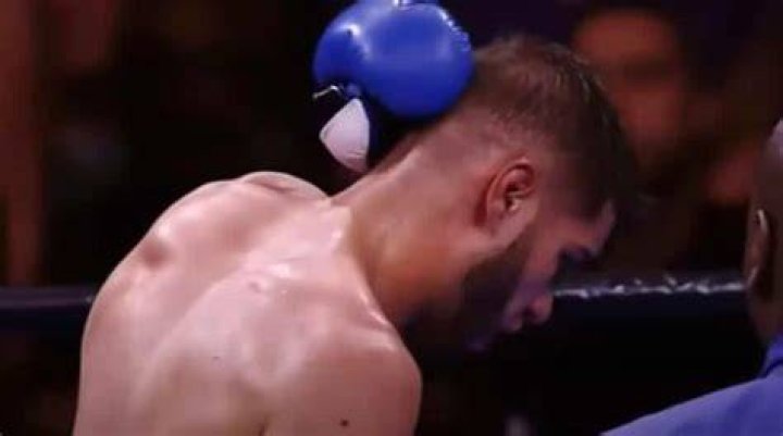 A Comprehensive Guide To "Boxer That Got Hit In The Back Of The Head"