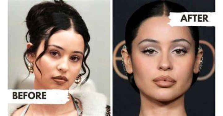 Alexa Demie before and after surgery ·