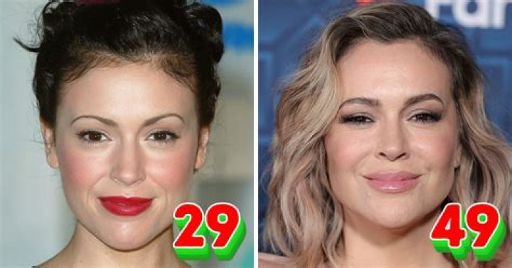 Alyssa Milano Plastic Surgery – Before And After Pics, Age And Net Worth 2023