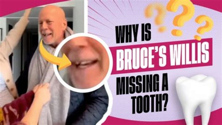 Bruce Willis Tooth