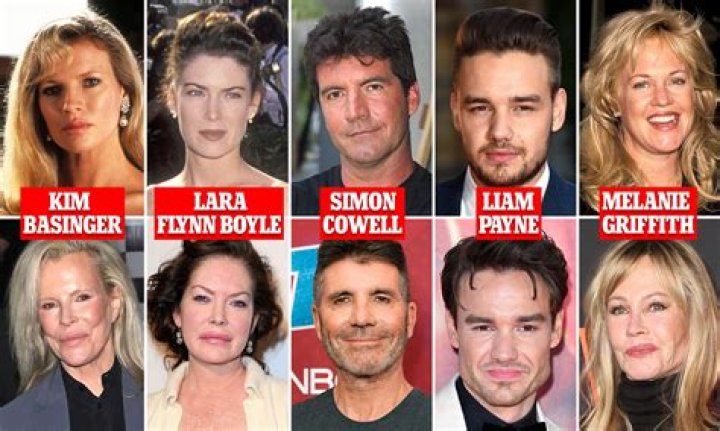 Did Clea Shearer Have Plastic Surgery? Facts To Know About The Reality TV Star