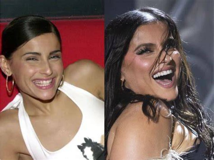 Did Nelly Furtado Get Plastic Surgery: Before & After!