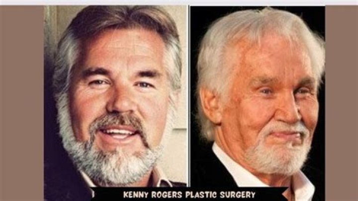 Discover The Unseen Transformation Of Kenny Rogers: Before And After Revealed