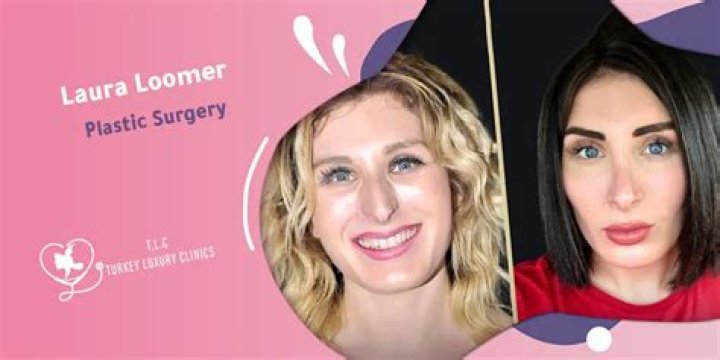 Exploring "is Laura Loomer Trans Partner Gender And"