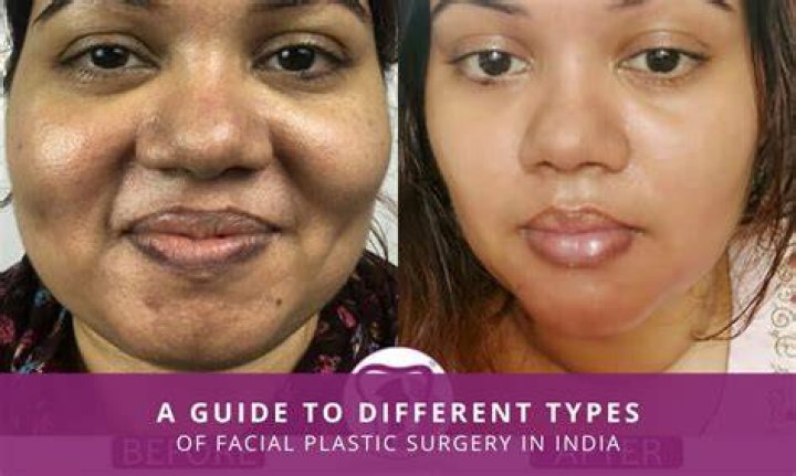Gio's Approach To Plastic Surgery For OC Moms