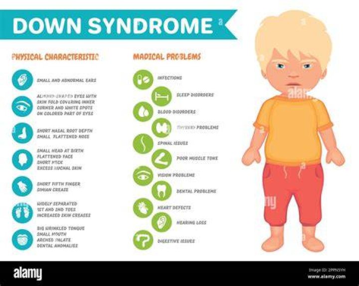Groundbreaking Insights Into Down Syndrome And Well-being