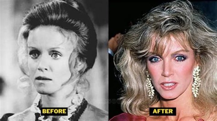 Has Donna Mills Had Plastic Surgery? The Truth Revealed