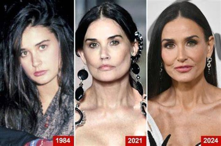 Has Fran Drescher Had Plastic Surgery?Unraveling the Plastic Surgery Rumors