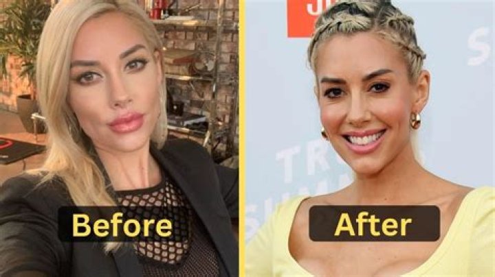Heather Rae Young Weight Loss – Before And After Plastic Surgery, Age And Height
