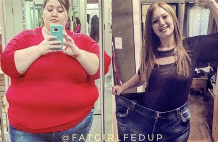 How A Woman Lost 300 Pounds And Celebrated With Inspiring Photos