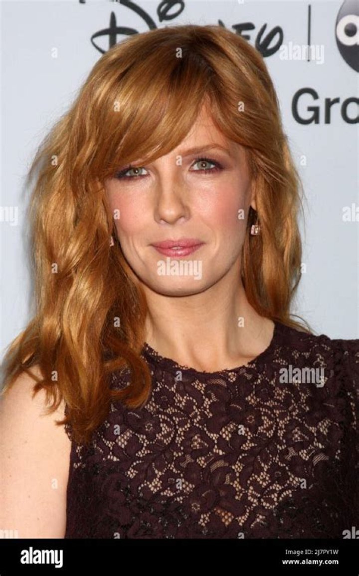 Kelly Reilly's Lip Job And The Secrets Within