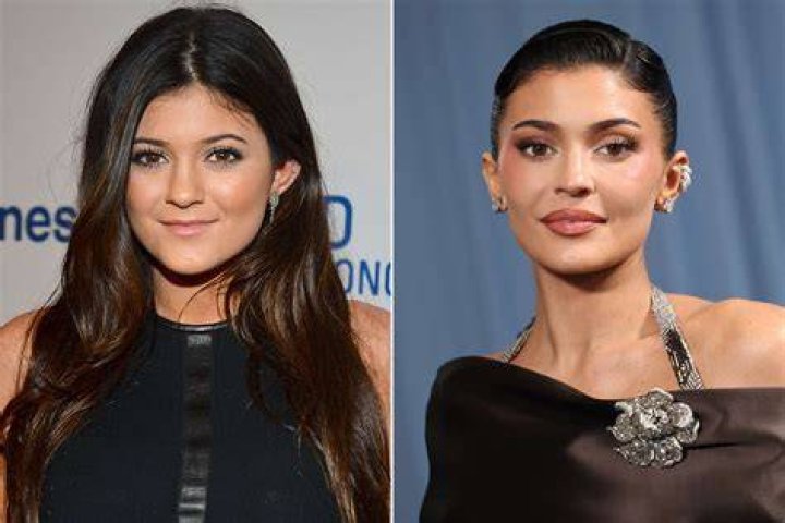 KYLIE JENNER PLASTIC SURGERY RUMORS ADDRESSED-Video |