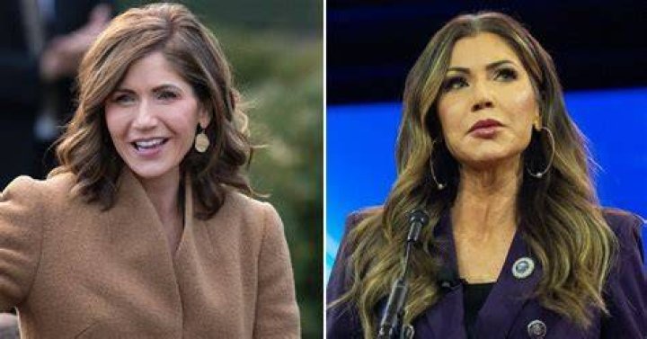 Lisa Helou's Plastic Surgery Journey Revealed
