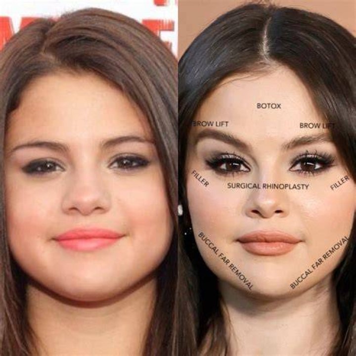 Marilyn Grabowski Accident And Face Surgery: Before And After Photos