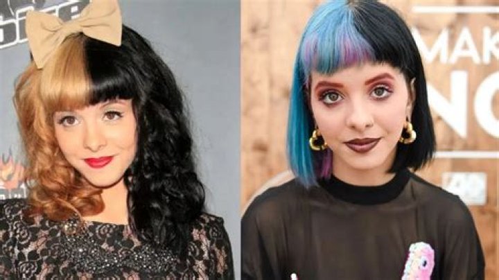 Melanie Martinez's Plastic Surgery Journey Explored