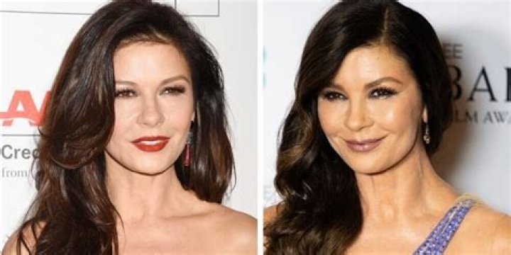 Mikaela Testa Debates Plastic Surgery Claims Back And Forth