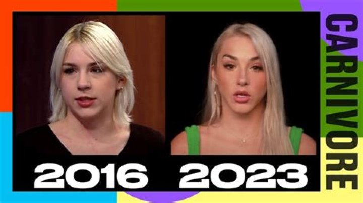 Mikhaila Peterson's Plastic Surgery Journey: Uncovering The Truths