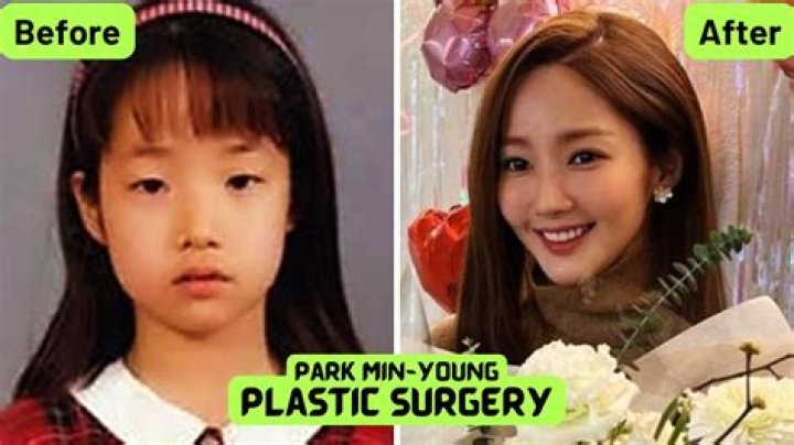 Park Min Young's Journey Before And After