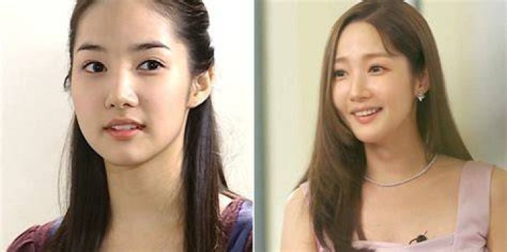 Park Min Young's Surgery: Unlocking Beauty's Secrets