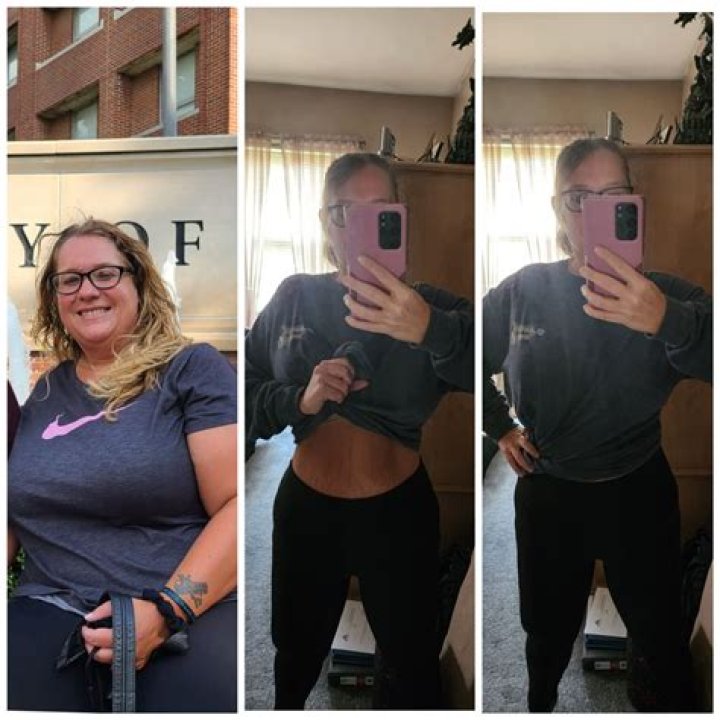 Qsymia Before And After Photos