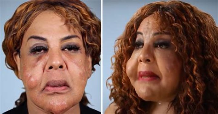 Rajee Narinesingh is loving her cheeky life after Botched transformation ·