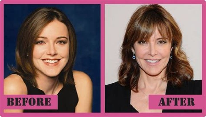 Shrinking: Christa Miller Plastic Surgery Before And After Pics Age And Husband