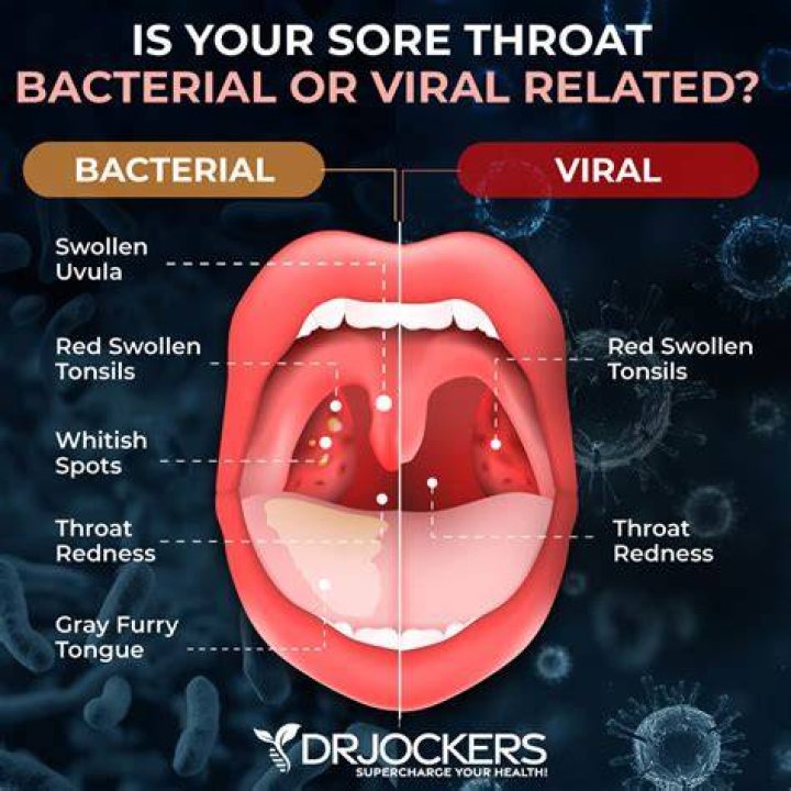 Sprite's Potential In Soothing Sore Throats