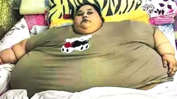 The Fattest Person in the World |