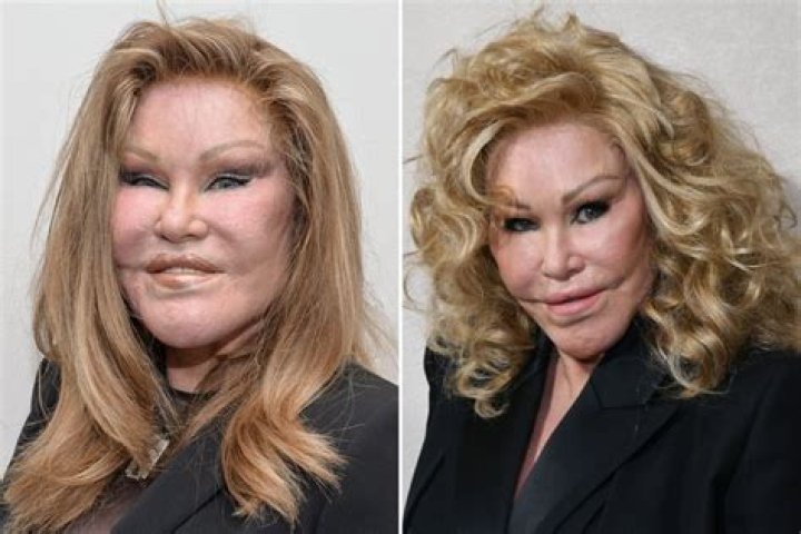 The Life of Jocelyn Wildenstein's Daughter