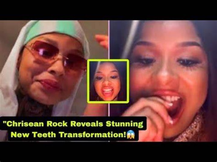 The Untold Story Behind Chrisean Rock's Teeth