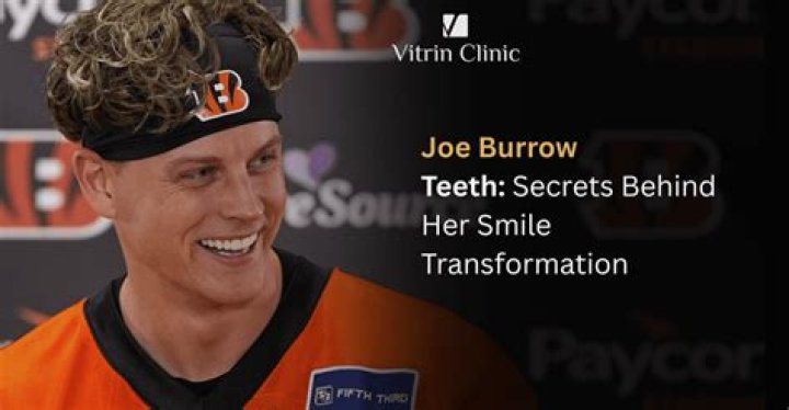 Uncover The Secrets Behind Joe Burrow's Captivating Smile