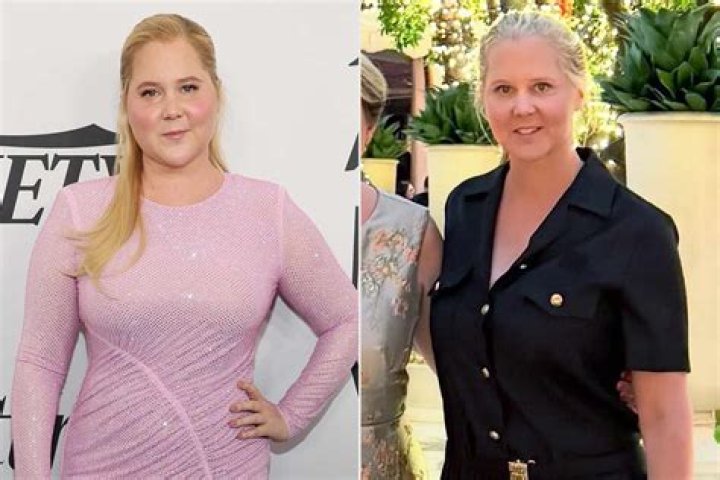 Uncovering The Influence Of Amy Schumer's Parents On Her Success