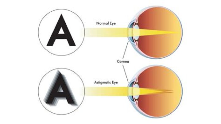 Unlock The Secrets Of Safe Driving With Astigmatism