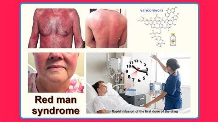 Unlocking The Enigma Of Redman Health Conditions: Discoveries And Insights Await