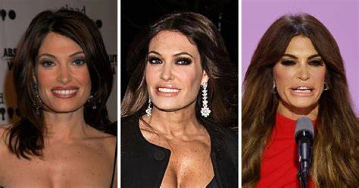 Unlocking The Secrets Of Kim Guilfoyle's Transformation