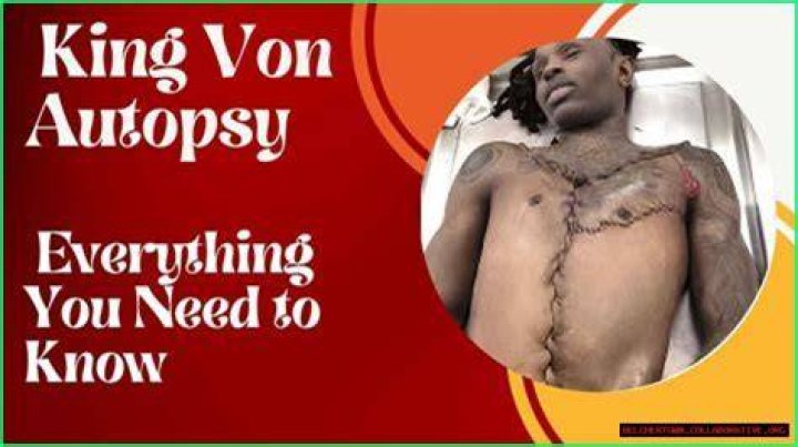 Unraveling The King Von Autopsy Results
