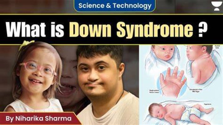 Unraveling The Truth Behind Down Syndrome Rumors