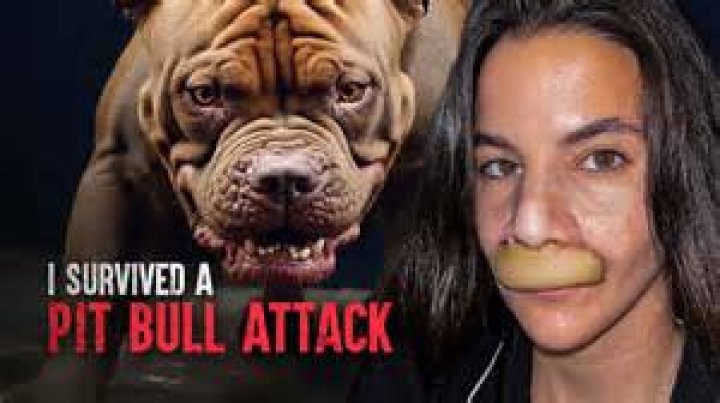 Unraveling The "Woman Behind Racist Pitbull Audio" Incident