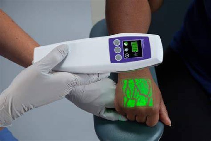 Unveil The Secrets Of Vein Visibility: A Comprehensive Exploration