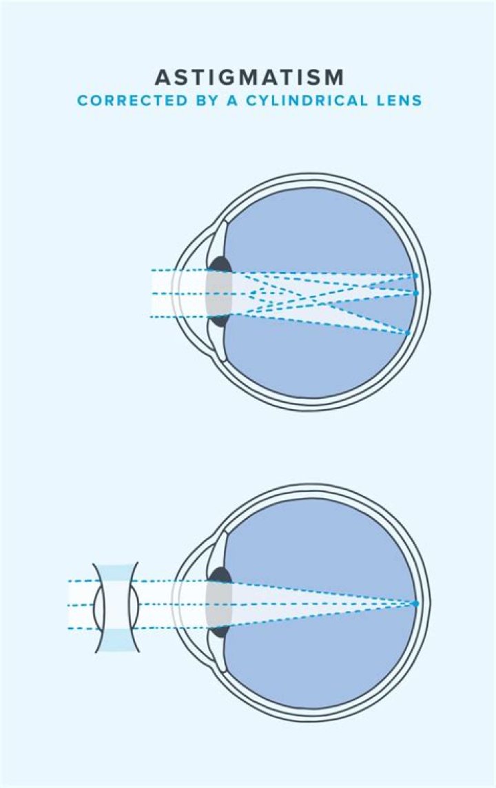 Unveiling Astigmatism's Impact On Driving: A Comprehensive Guide
