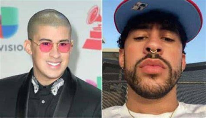 Unveiling Bad Bunny's Transformation: Discoveries From Cosmetic Surgery