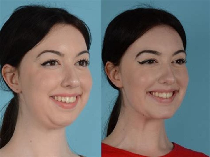 Unveiling Before & After Secrets
