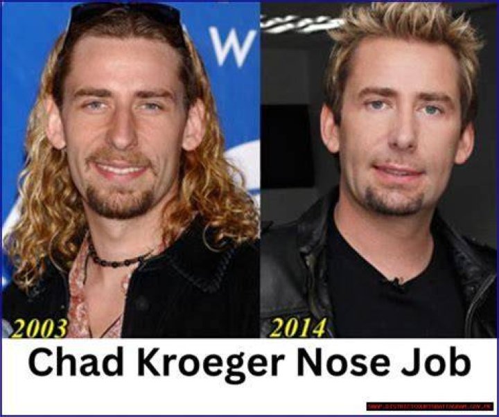 Unveiling Chad Kroeger's Stature: Height And Significance Explored