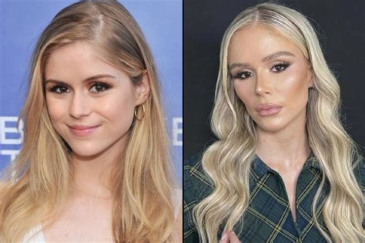 Unveiling Lisa Before Plastic Surgery: Surprising Revelations