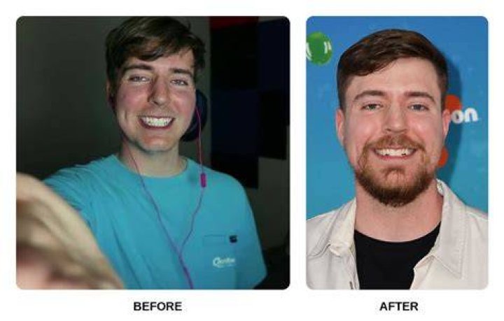 Unveiling The Evolution: Matt Rife's Smile Transformation