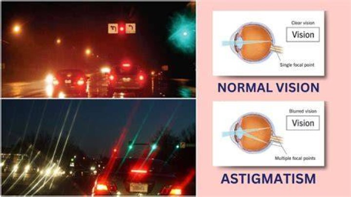 Unveiling The Secrets Of Astigmatism Lights At Night: Discoveries And Insights
