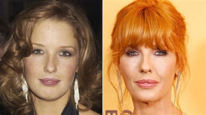 Unveiling The Secrets Of "Kelly Reilly Lip Injections": Discoveries & Insights