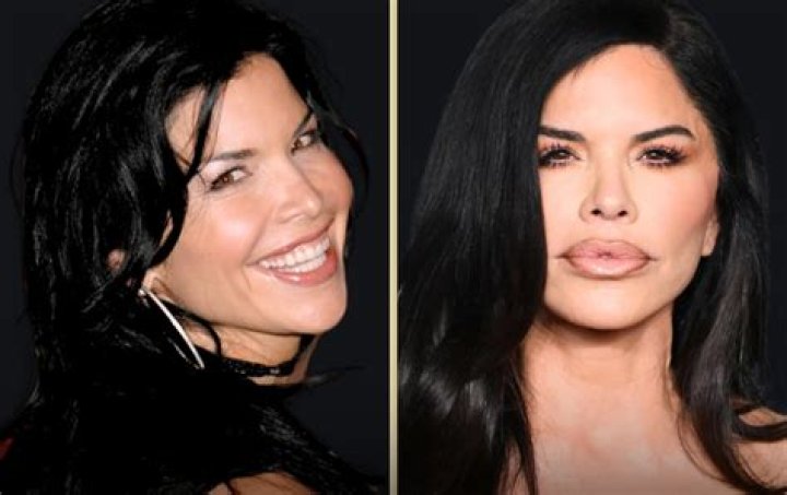 Unveiling The Secrets Of Lauren Sanchez's Transformation: Plastic Surgery Revealed