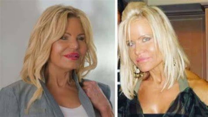 Unveiling The Secrets Of Lisa Helou Plastic Surgery