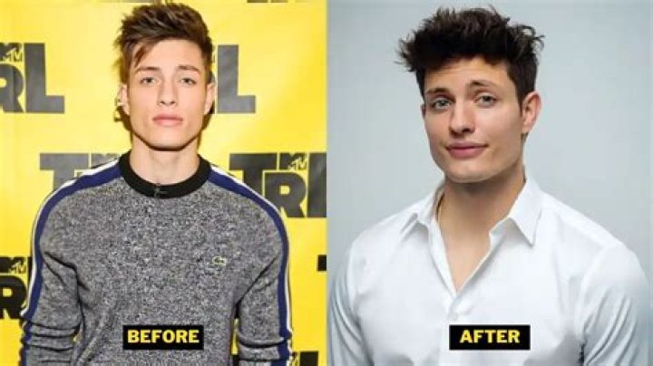 Unveiling The Secrets Of Matt Rife's Astonishing Glow Up